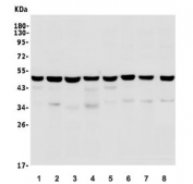 Western blot testing of rat 1) brain, 2) testis, 3) liver, 4) spleen and mouse 5) brain, 6) testis, 7) liver and 8) spleen lysate with TSG101 antibody. Predicted molecular weight ~45 kDa.