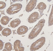 IHC staining of FFPE mouse testis with VDAC3 antibody. HIER: boil tissue sections in pH8 EDTA for 20 min and allow to cool before testing.