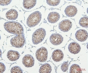 IHC staining of FFPE rat testis with VDAC3 antibody. HIER: boil tissue sections in pH8 EDTA for 20 min and allow to cool before testing.