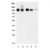 Western blot testing of human 1) MCF7, 2) MDA-MB-453, 3) HEK293, 4) rat brain and 5) mouse brain lysate with KIBRA antibody. Predicted molecular weight ~125 kDa.