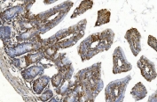 IHC staining of FFPE mouse intestine with YTHDF2 antibody. HIER: boil tissue sections in pH8 EDTA for 20 min and allow to cool before testing.