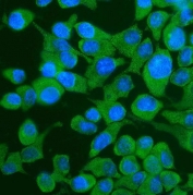 Immunofluorescent staining of FFPE human HepG2 cells with YTHDF2 antibody (green) and DAPI nuclear stain (blue). HIER: steam section in pH6 citrate buffer for 20 min.