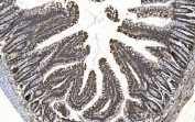 IHC staining of FFPE rat intestine with YTHDF2 antibody. HIER: boil tissue sections in pH8 EDTA for 20 min and allow to cool before testing.