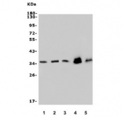 Western blot testing of 1) human HeLa, 2) human HepG2, 3) monkey COS-7, 4) rat PC-12 and 5) mouse NIH 3T3 lysate with PPP2CA antibody. Predicted molecular weight ~35 kDa.