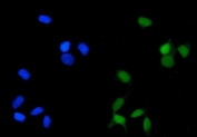 Immunofluorescent staining of FFPE human HeLa cells with PPP2CA antibody (green) and DAPI nuclear stain (blue). HIER: steam section in pH6 citrate buffer for 20 min.