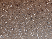 IHC staining of FFPE rat brain with PPP2CA antibody. HIER: boil tissue sections in pH8 EDTA for 20 min and allow to cool before testing.