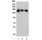 Western blot testing of human 1) MCF7, 2) SW620 and 3) K562 lysate with TRIM33 antibody. Predicted molecular weight ~122 kDa but routinely observed at ~155 kDa.