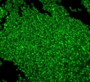 Immunofluorescent staining of FFPE human tonsil with MCM2 antibody. HIER: boil tissue sections in pH8 EDTA for 20 min and allow to cool before testing.
