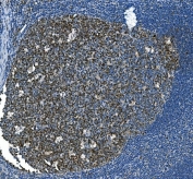 IHC staining of FFPE human tonsil with MCM2 antibody. HIER: boil tissue sections in pH8 EDTA for 20 min and allow to cool before testing.