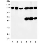 Western blot testing of human 1) HeLa, 2) Caco-2, 3) monkey COS7 and human 4) HL-60, 5) HEK293 and 6) ThP-1 lysate with MCM2 antibody. Predicted molecular weight: 100~130 kDa.