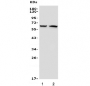 Western blot testing of 1) rat brain and 2) mouse brain lysate with GAD2 antibody. Predicted molecular weight ~65 kDa.