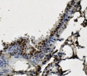 IHC staining of FFPE mouse lung with HNRNPD antibody. HIER: boil tissue sections in pH8 EDTA for 20 min and allow to cool before testing.