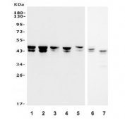 Western blot testing of human 1) HEK293, 2) K562, 3) A431, 4) HepG2, 5) placenta, 6) rat brain and 7) mouse brain lysate with HNRNPD antibody. Expected molecular weight: multiple bands from 37-45 kDa.