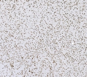 IHC staining of FFPE rat brain with hnRNP D antibody. HIER: boil tissue sections in pH8 EDTA for 20 min and allow to cool before testing.