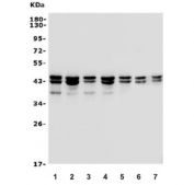 Western blot testing of human 1) HEK293, 2) K562, 3) A431, 4) HepG2, 5) placenta, 6) rat brain and 7) mouse brain lysate with hnRNP D antibody. Expected molecular weight: multiple bands from 37-45 kDa.