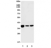 Western blot testing of 1) rat liver, 2) mouse liver and 3) monkey liver lysate with ARG1 antibody. Predicted molecular weight ~35 kDa.