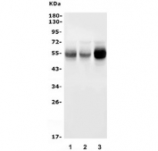 Western blot testing of 1) monkey liver, 2) rat liver and 3) mouse liver lysate with CYP2C19 antibody. Predicted molecular weight ~56 kDa.