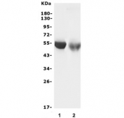 Western blot testing of 1) rat liver and 2) mouse liver lysate with CYP2C19 antibody. Predicted molecular weight ~56 kDa.