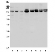Western blot testing of 1) human HEK293, 2) human HepG2, 3) human U-2 OS, 4) monkey liver, 5) rat liver, 6) rat kidney, 7) mouse liver and 8) mouse kidney lysate with ACO1 antibody. Predicted molecular weight ~98 kDa.