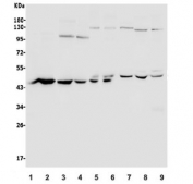 Western blot testing of 1) rat kidney, 2) rat spleen, 3) mouse HEPA1-6, 4) mouse SP2/0, 5) monkey COS-7 and human 6) U-87 MG, 7) Jurkat, 8) PC-3 and 9) U-2 OS lysate with ACTR2 antibody. Predicted molecular weight ~45 kDa.
