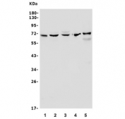 Western blot testing of human 1) SW620, 2) HepG2, 3) Raji, 4) rat heart and 5) mouse heart lysate with ALAS1 antibody. Predicted molecular weight ~71 kDa.