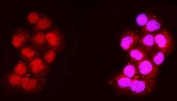 Immunofluorescent staining of FFPE human A431 cells with ALAS1 antibody (left) and ALAS1 antibody + DAPI nuclear stain (right). HIER: steam section in pH6 citrate buffer for 20 min.