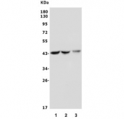 Western blot testing of mouse 1) liver, 2) heart and 3) Neuro-2a lysate with As3mt antibody. Predicted molecular weight ~42 kDa.