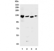 Western blot testing of 1) mouse testis, 2) rat heart, 3) rat PC-3 and 4) rat RH35 lysate with Bub1 antibody. Predicted molecular weight ~122 kDa.
