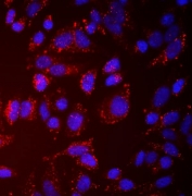 Immunofluorescent staining of FFPE human HeLa cells with CALCOCO2 antibody (red) and DAPI nuclear stain (blue). HIER: steam section in pH6 citrate buffer for 20 min.