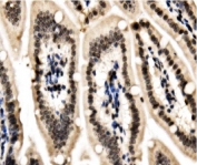 IHC staining of FFPE mouse intestine with HP1 alpha antibody. HIER: boil tissue sections in pH8 EDTA for 20 min and allow to cool before testing.