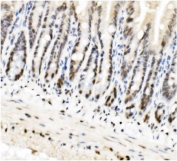 IHC staining of FFPE rat intestine with HP1 alpha antibody. HIER: boil tissue sections in pH8 EDTA for 20 min and allow to cool before testing.