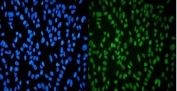 Immunofluorescent staining of FFPE human HeLa cells with HP1 alpha antibody (green) and DAPI nuclear stain (blue). HIER: steam section in pH6 citrate buffer for 20 min.