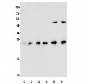 Western blot testing of human 1) U-87 MG, 2) K562, 3) Jurkat, 4) Raji, 5) rat PC-12 and 6) mouse SP2/0 lysate with HP1 alpha antibody. Predicted molecular weight ~22 kDa.