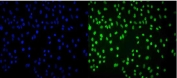 Immunofluorescent staining of FFPE human A549 cells with CBX8 antibody (green) and DAPI nuclear stain (blue). HIER: steam section in pH6 citrate buffer for 20 min.