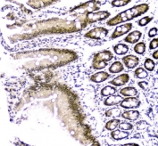 IHC staining of FFPE rat small intestine with CBX8 antibody. HIER: boil tissue sections in pH8 EDTA for 20 min and allow to cool before testing.