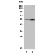 Western blot testing of mouse 1) RAW264.7 and 2) ANA-1 lysate with CD4 antibody. Expected molecular weight: 31-55 kDa depending on glycosylation level.