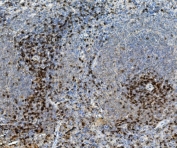 IHC staining of FFPE rat spleen with Cd8a antibody. HIER: boil tissue sections in pH8 EDTA for 20 min and allow to cool before testing.