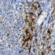 IHC staining of FFPE mouse spleen with Cd8a antibody. HIER: boil tissue sections in pH8 EDTA for 20 min and allow to cool before testing.