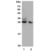 Western blot testing of 1) rat thymus and 2) mouse thymus lysate with Cd8a antibody. Expected molecular weight: 26-40 kDa depending on glycosylation level.