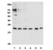 Western blot testing of human 1) K562, 2) HL-60, 3) Raji, 4) mouse SP2/0, 5) rat thymus and 6) mouse thymus lysate with CD69 antibody. Expected molecular weight: 22-32 kDa depending on glycosylation level.