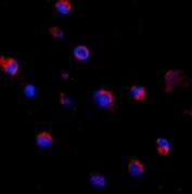 Immunofluorescent staining of FFPE human K562 cells with CD69 antibody (red) and DAPI nuclear stain (blue). HIER: steam section in pH6 citrate buffer for 20 min.