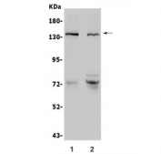 Western blot testing of human 1) LNCaP and 2) SGC-7901 lysate with CDH2 antibody. Predicted molecular weight ~100 kDa (unmodified), 125-140 kDa (modified).