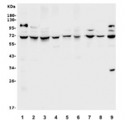 Western blot testing of human 1) HEK293, 2) SW620, 3) 22RV1, 4) ThP-1, 5) SGC-7901, 6) monkey COS-7, 7) rat kidney, 8) mouse heart and 9) mouse HEPA1-6 lysate with CLPB antibody. Expected molecular weight: 72-79 (multiple isoforms).