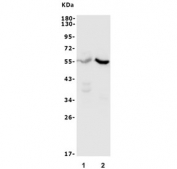 Western blot testing of 1) rat kidney and 2) mouse kidney lysate with CYP11B1/2 antibody. Predicted molecular weight ~55 kDa.