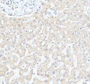 IHC staining of FFPE human liver tissue with CYP27A1 antibody, HRP-secondary and DAB substrate. HIER: boil tissue sections in pH8 EDTA for 20 min and allow to cool before testing.