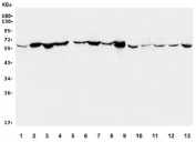 Western blot testing of human 1) placenta, 2) HepG2, 3) Caco-2, 4) SW620, 5) SGC-7901, 6) HEK293, 7) monkey liver, 8) human U-2 OS, 9) rat liver, 10) rat heart, 11) mouse liver, 12) mouse heart and 13) mouse NIH 3T3 lysate with CYP27A1 antibody. Expected molecular weight: 60-65 kDa.