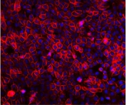 Immunofluorescent staining of FFPE human A431 cells with EGF Receptor antibody (red) and DAPI nuclear stain (blue). HIER: steam section in pH6 citrate buffer for 20 min.