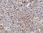 IHC staining of FFPE mouse liver with EGF Receptor antibody. HIER: boil tissue sections in pH8 EDTA for 20 min and allow to cool before testing.