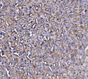 IHC staining of FFPE rat liver with EGF Receptor antibody. HIER: boil tissue sections in pH8 EDTA for 20 min and allow to cool before testing.