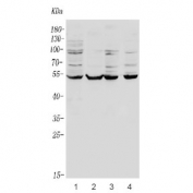 Western blot testing of 1) monkey skeletal muscle, 2) human A431, 3) human HT1080 and 4) rat skeletal muscle with EYA4 antibody. Expected molecular weight: 52-69 kDa.